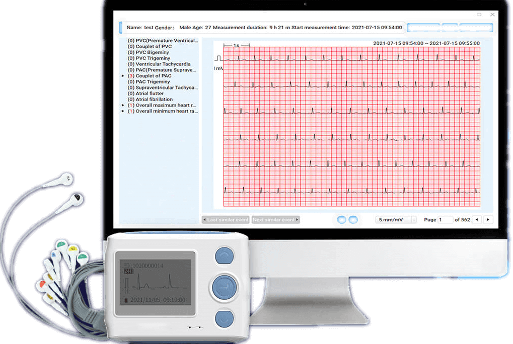Blog Some Basic Facts about EKG MDcubes